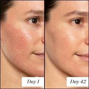 SUNDAY RILEY Gói Tinh chất chống lão hoá A+ High-Dose Retinol Serum 1ml NỘI ĐỊA MỸ