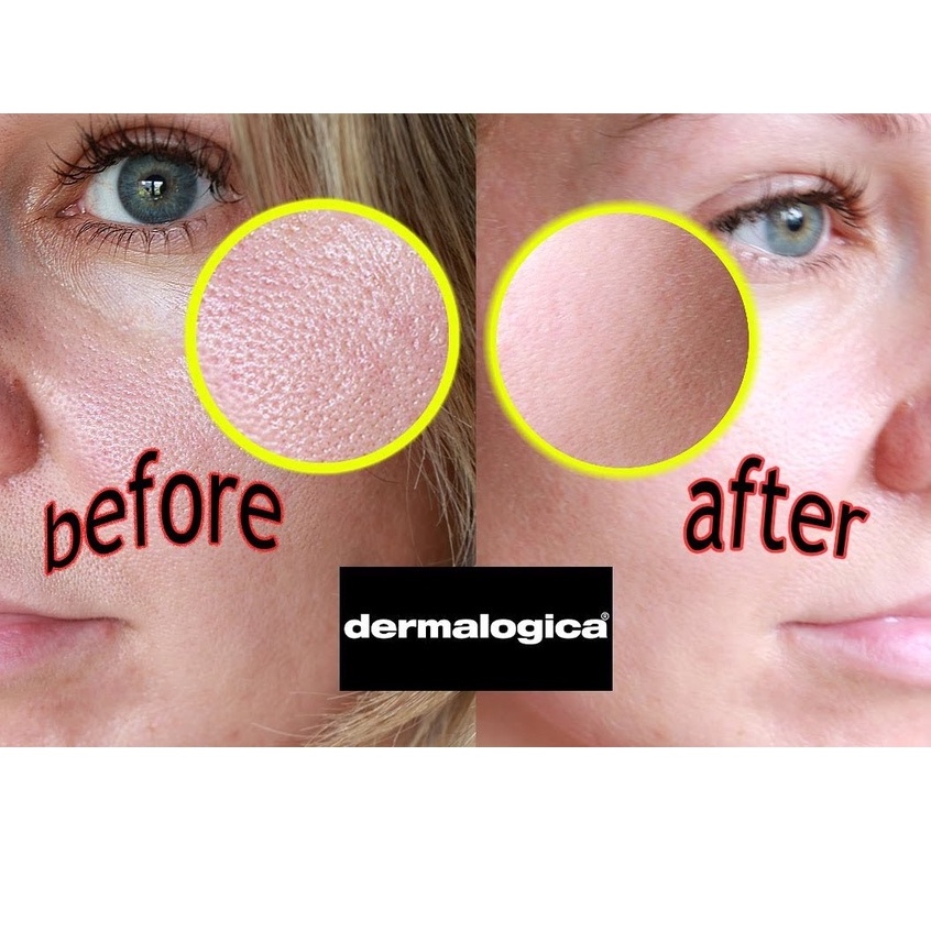 Dermalogica UltraBright Peel - Peel Làm Sáng Da Mờ Nám, Chống Lão Hóa Chuyên Sâu 118ml