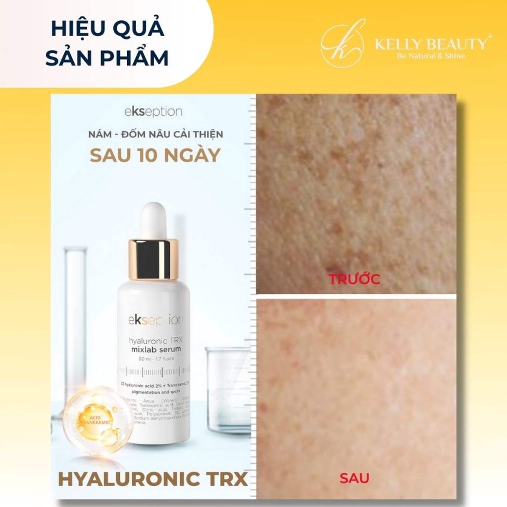 Serum sáng da, mờ nám EKSEPTION Hyaluronic TRX Serum 50ml