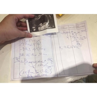 Vitamin tổng hợp cho mẹ bầu Pregnacare Max