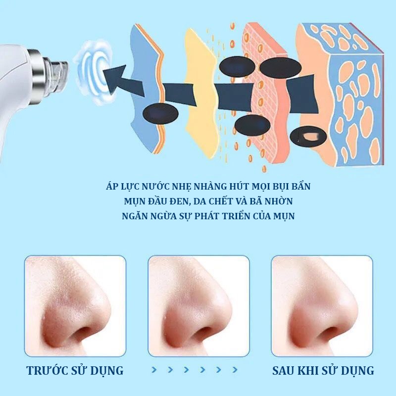 Máy hút mụn đầu đen, Máy hút mụn bằng áp lực nước nano, hút mụn cám, 3 chế độ giúp đẩy nhanh quá trình lấy nhân mụn