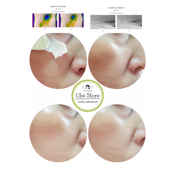 SET DƯỠNG MINI CHỐNG LÃO HOÁ IOPE SUPER VITAL SPECIAL GIFT (5 SẢN PHẨM) | BigBuy360 - bigbuy360.vn