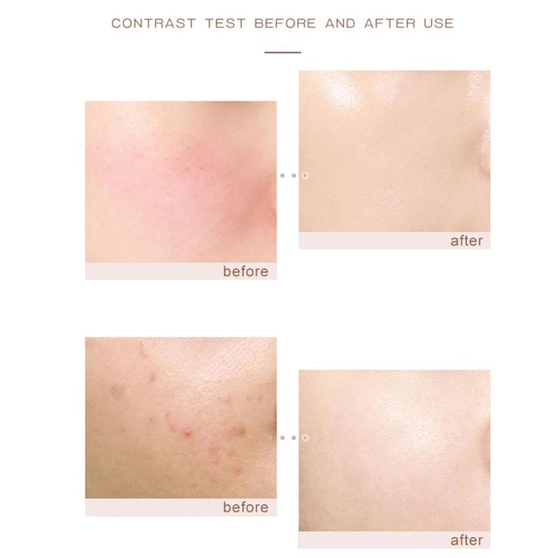 (Hàng Mới Về) Kem Dưỡng Ẩm Làm Sáng Tông Màu Da Thương Hiệu Hold Live N1Q8 | BigBuy360 - bigbuy360.vn