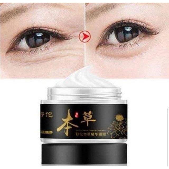 Kem loại bỏ mụn thịt thừa, mụn thịt quanh mắt GENTIAN EYE CREAM