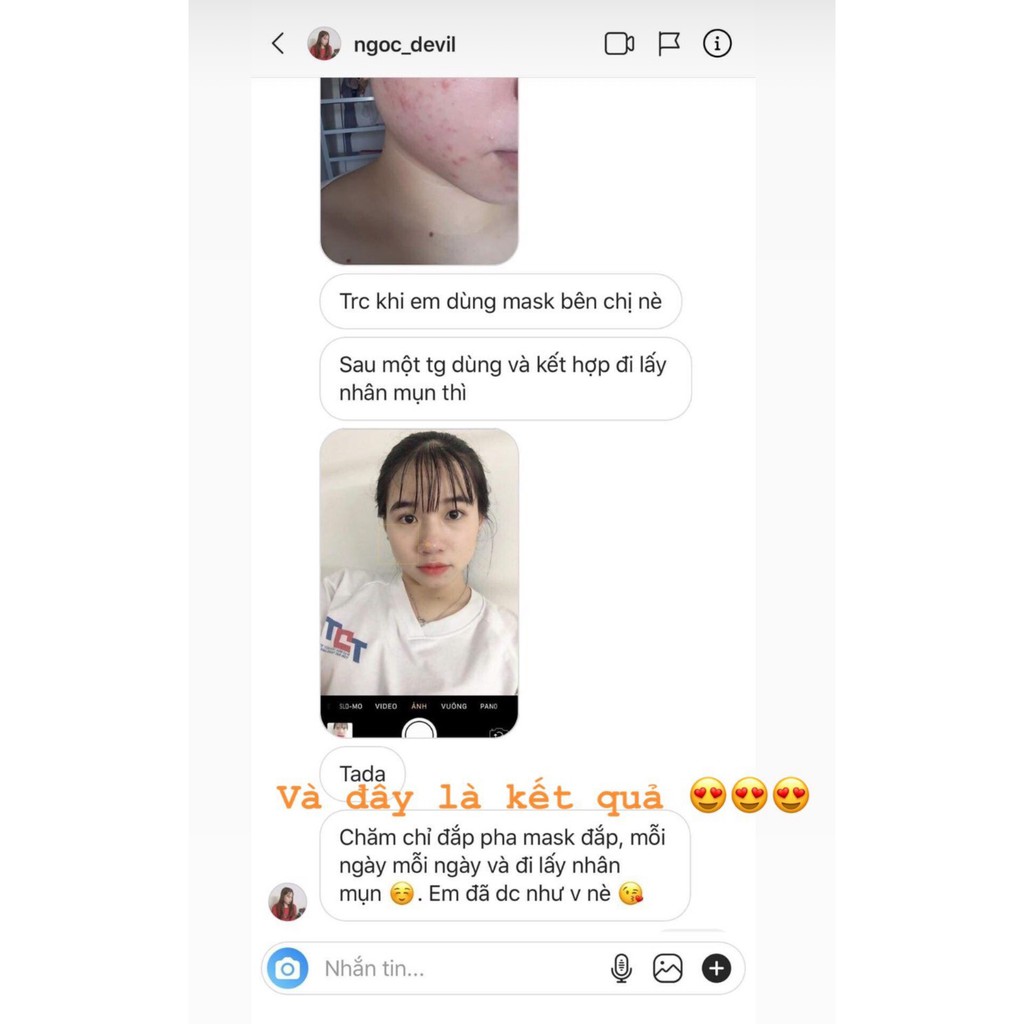 ( TOP SẢN PHẨM KIỂM SOÁT MỤN ) MẶT NẠ ĐẨY MỤN HIMALAYA Handmade | BigBuy360 - bigbuy360.vn