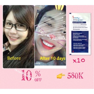Liệu trình 10 ngày - Miếng dán trắng răng CREST WHITESTRIPS SUPREME PROFESSIONAL WHITENING