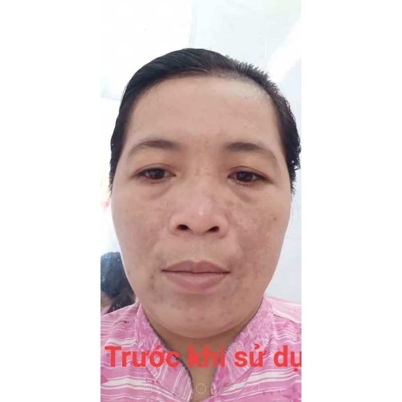 Kem tái tạo chamomile