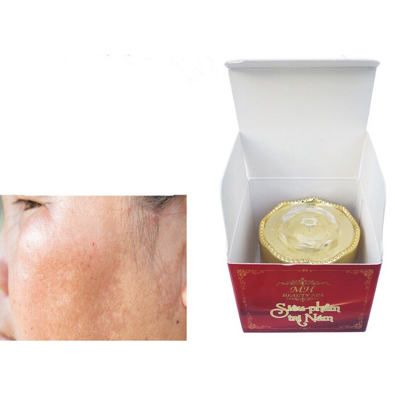 SIÊU PHẨM NÁM ĐỎ