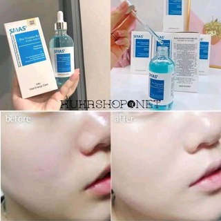 SERUM CẤP ẨM B5 SMAS