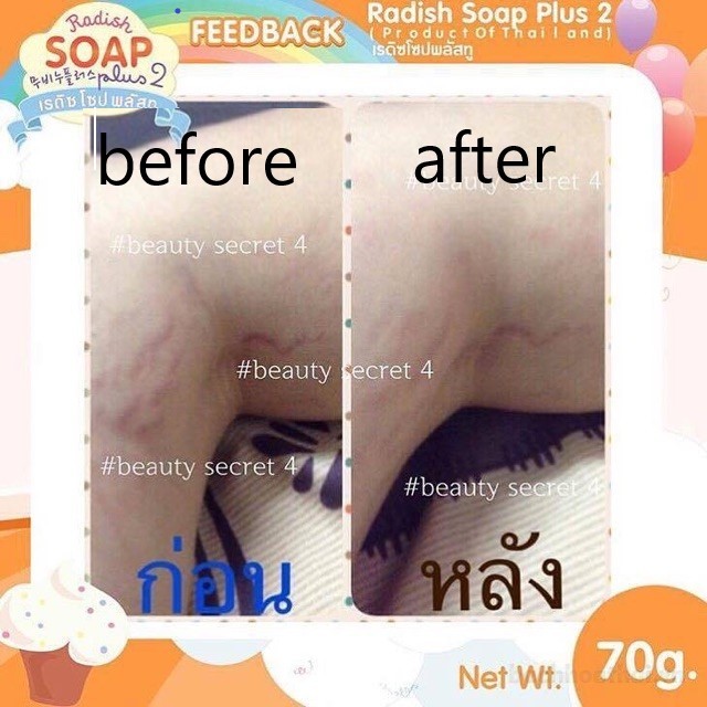 Xà phòng xoá rạn làm trắŉg da Beauty Secret 4 Whitening Soap Radish &amp; Peach