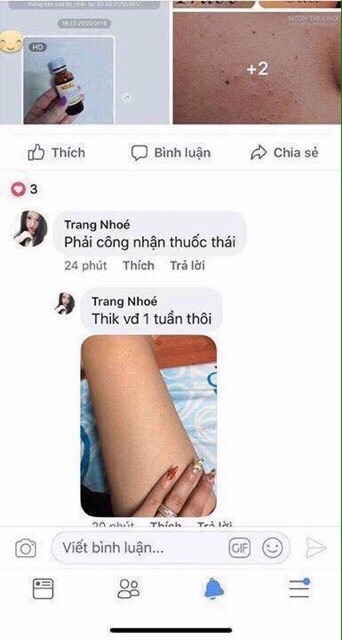 kela lotion trị viêm lỗ lang lông ( hàng chuẩn) | BigBuy360 - bigbuy360.vn