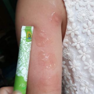 Gel bôi da Phú KANG