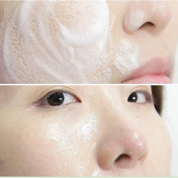 Sữa rửa mặt dành cho da mụn innisfree Bija Trouble Facial Foam 150g