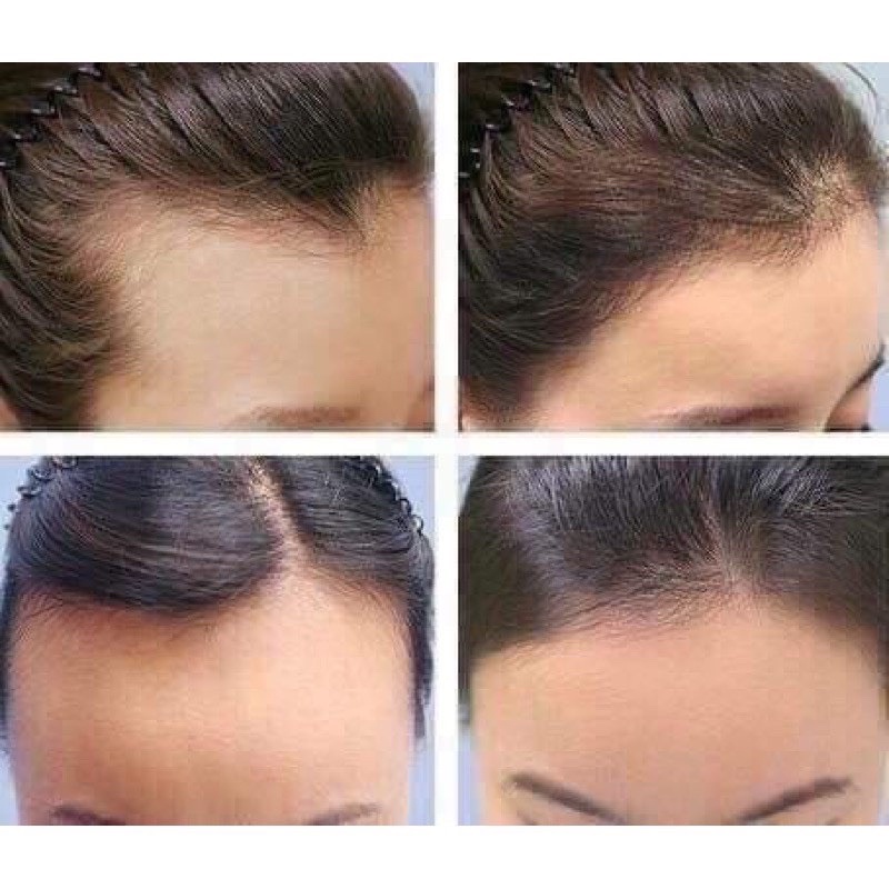XỊT MỌC TÓC BƯỞI CHANH THÁI LAN