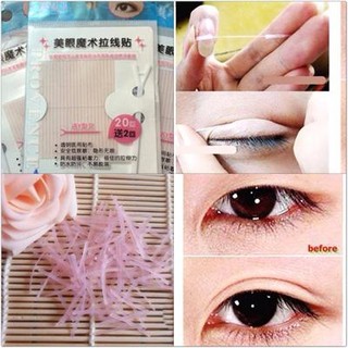 Chỉ tạo mắt 2 mí siêu tự nhiên