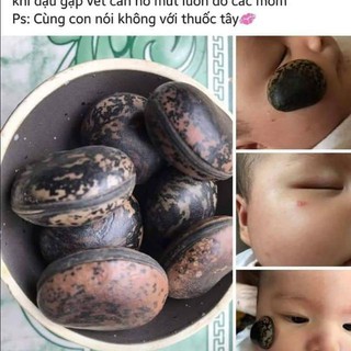HẠT ĐẬU LÀO HÚT ĐỘC (5 hạt )
