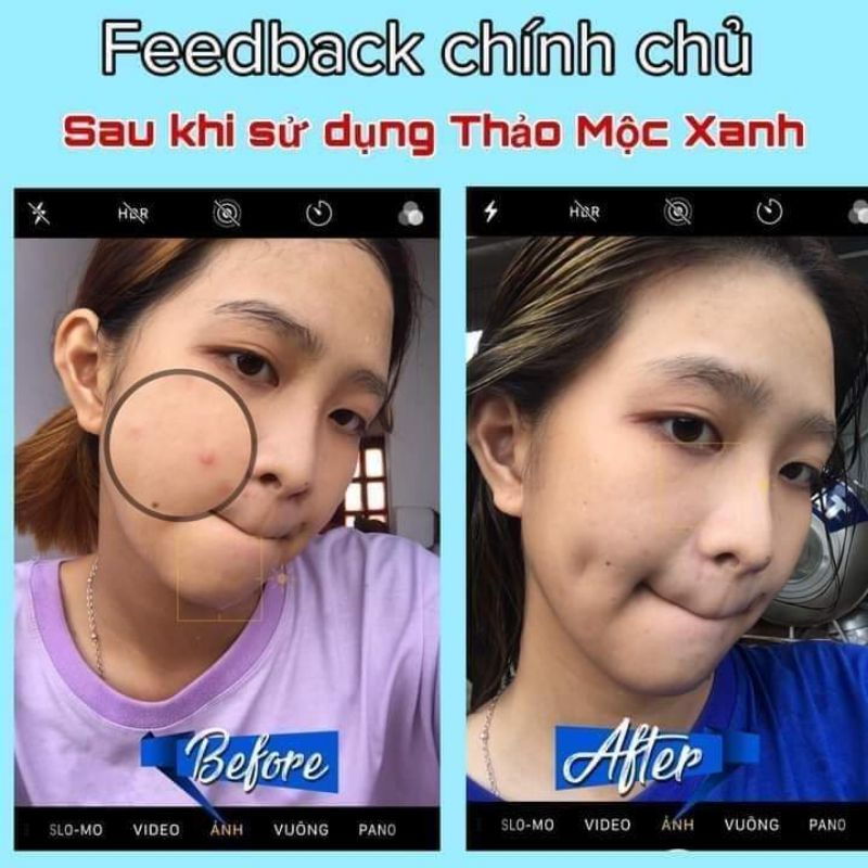 (Sẵn hàng) Combo trắng da- căng bóng trong 7 ngày 2 lọ | BigBuy360 - bigbuy360.vn