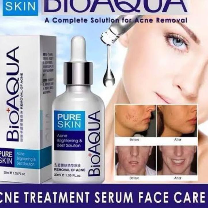 (Hàng Mới Về) Tinh Chất Trị Mụn Làm Sáng Da Bioaqua