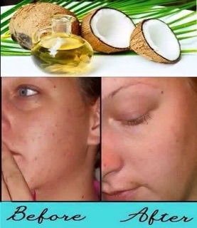 DẦU DỪA NGUYÊN CHẤT CẦU BÌNH AN