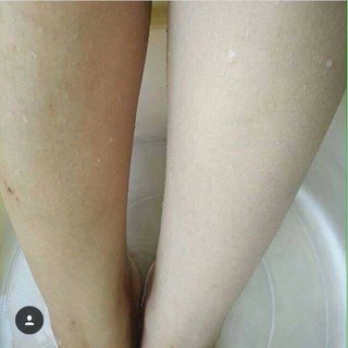 ✅ tắm trắng thuốc bắc được làm ra để dưỡng trắng body nhưng nó là bước rút ngắn thời gian dưỡng body lại