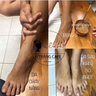 Ủ Trắng Cà Phê - Since 2013 ( cam kết hàng chính hãng )