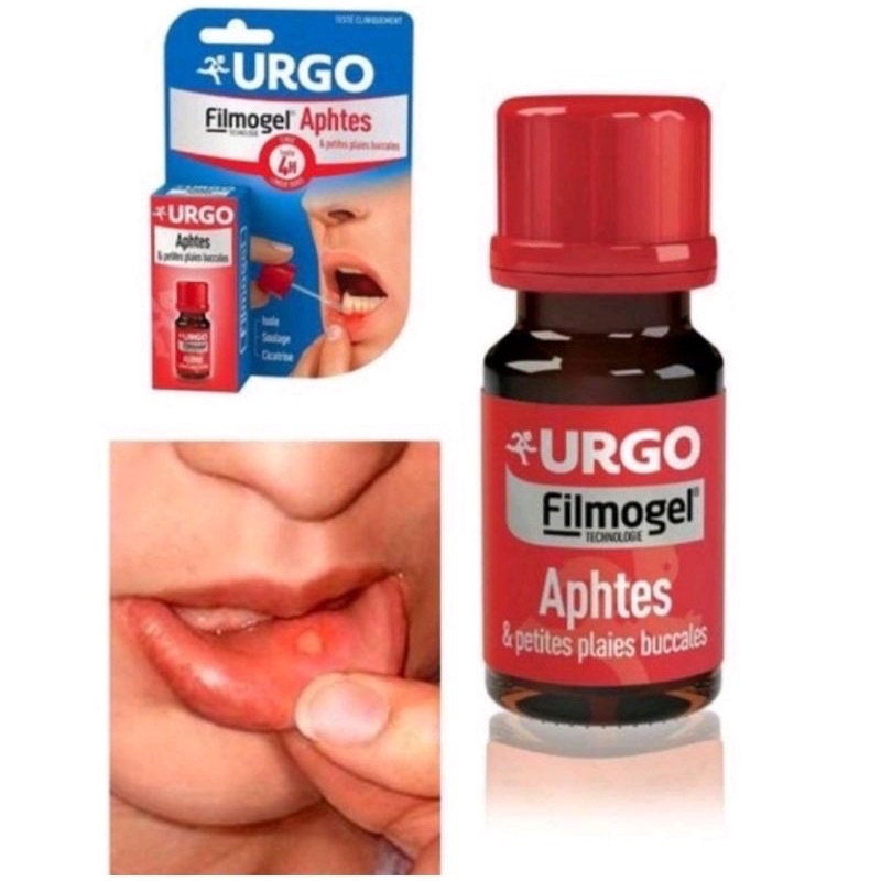Gel Bôi Nhiệt Miệng, Lở Miệng Urgo Filmogel Mouth Ulcers- Hiệu Quả Ngay Cả Lúc Ă
