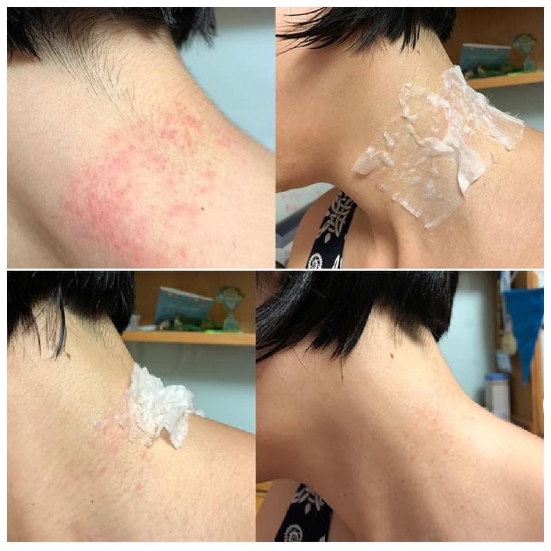 Nước hoa hồng se khít lỗ chân lông , ngừa mụn Physiodermie