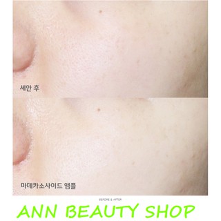 Tinh Chất Dưỡng Apieu Madecassoside Ampoule 30ml