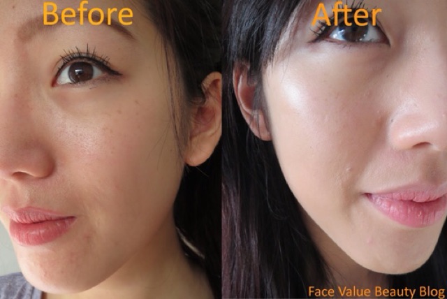 Kem nền Clinique Acne Solutions Liquid Makeup – Không gây mụn cho làn da dầu, nhạy cảm