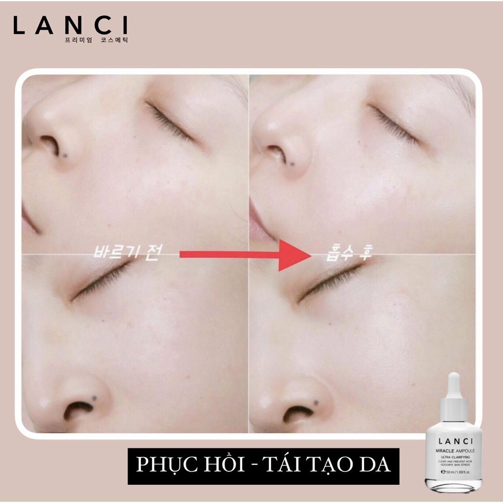 Siêu Serum MIRACLE AMPOULE LANCI - Giúp  làm sáng da căng bóng