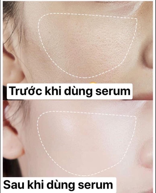 Serum Heyxi - tinh chất se khít lỗ chân lông hiệu quả | BigBuy360 - bigbuy360.vn