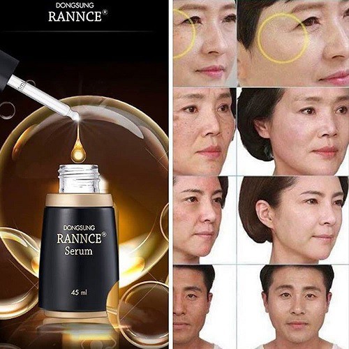 Bộ nám Dongsung 3 sản phẩm (toner-serum-cream)