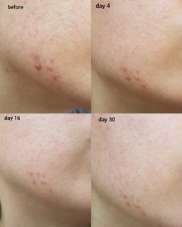 [Gốc 1360k] Dầu dưỡng Biossance Squalane + Tea Tree Balancing fullsize 30ml