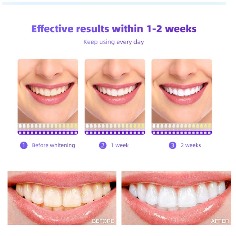 Máy làm trắng răng 20 Munite Dental White sử dụng ánh sáng xanh giúp trắng răng cải thiện ố vàng sau 2 tuần sd