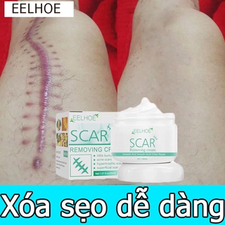 [Xóa sẹo nhanh chóng] EELHOE kem xóa sẹo, xoá sẹo bỏng,sẹo mụn,sẹo trầy xước.khổi phục da nhanh chóng,xóa rạn da,kem xóa sẹo