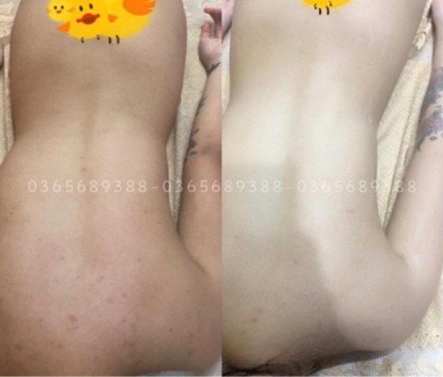 TẮM TRẮNG CAO CẤP - PHI THUYỀN, LỒNG HẤP, TẠI NHÀ