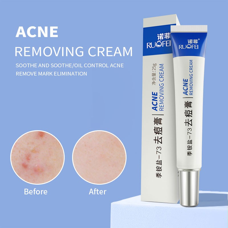 RUOALL Tinh Dầu GIÚP LÀM MỌC TÓC, HẾT RỤNG TÓC VÀ LÀM DÀI_MƯỢT 30G