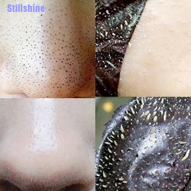 Set 10 Mặt Nạ Lột Mụn Đầu Đen Làm Sạch Sâu Vùng Mũi