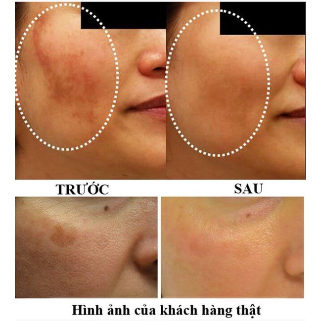 Thực Phẩm Chức Năng Transino 1 Hộp - 240 viên