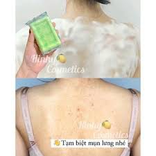 Xà Phòng Mụn Soap AHA-BHA-PHA 7 Days Miracle Cleansing Bar derladie