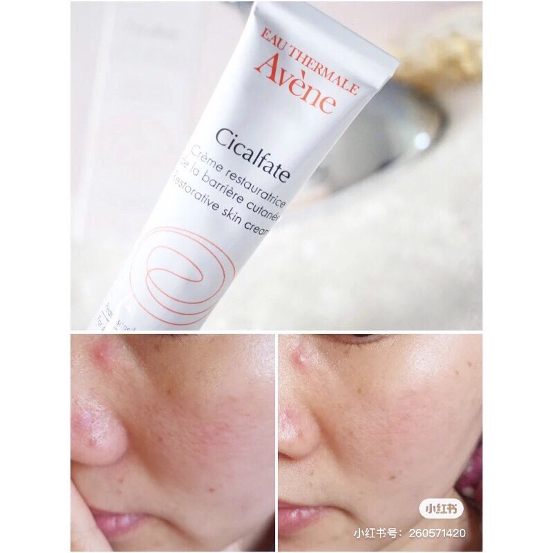 Kem dưỡng tái tạo, phục hồi da Avene Cicalfate Repair Cream 40ml