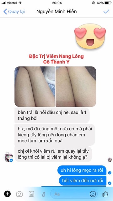 01 kem bôi #viêm nang lông | BigBuy360 - bigbuy360.vn