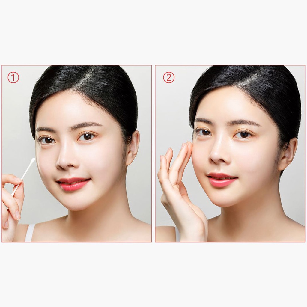 Kem giảm mụn SOME BY MI AHA-BHA-PHA cấp tốc 14 ngày thần kỳ 30ml