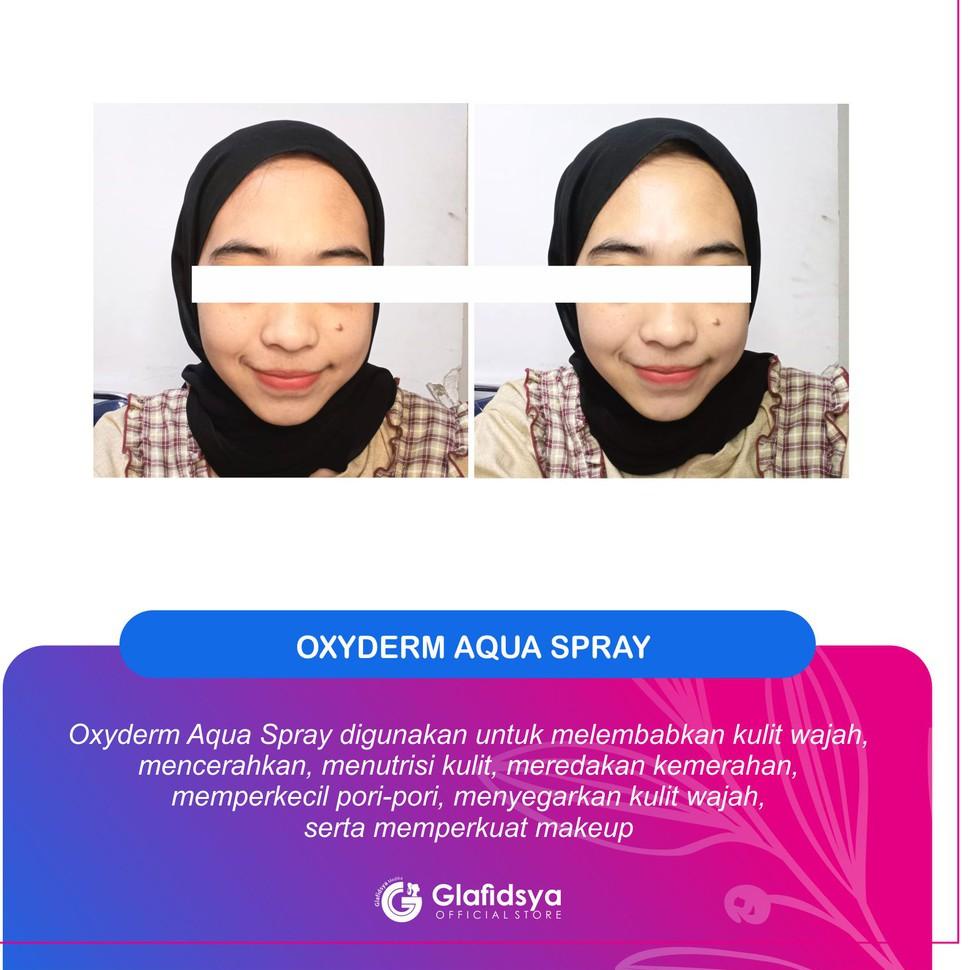 Mới PRODUCT	Viêm xương khớp mãn tính | Glafidsya | Chăm sóc da | Mỹ phẩm | BigBuy360 - bigbuy360.vn