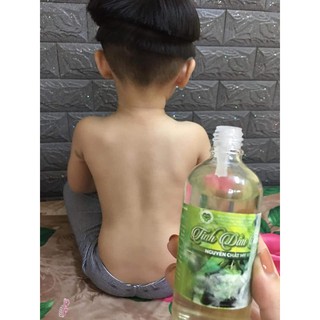 DẦU TRÀM MẸ KEN
