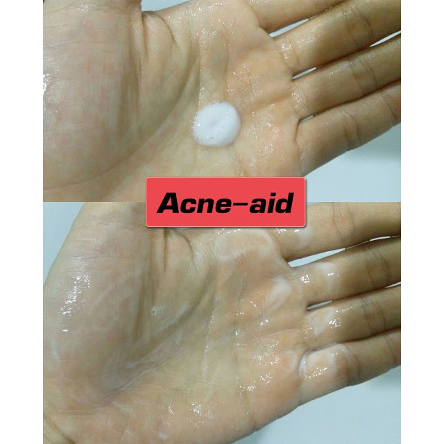 Sữa rửa mặt làm sạch và ngăn ngừa mụn Acne-Aid Liquid Cleanser (30ml)