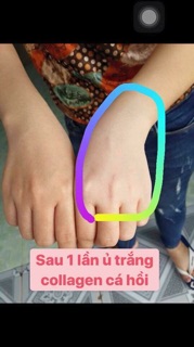 Ủ trắng da body cá hồi