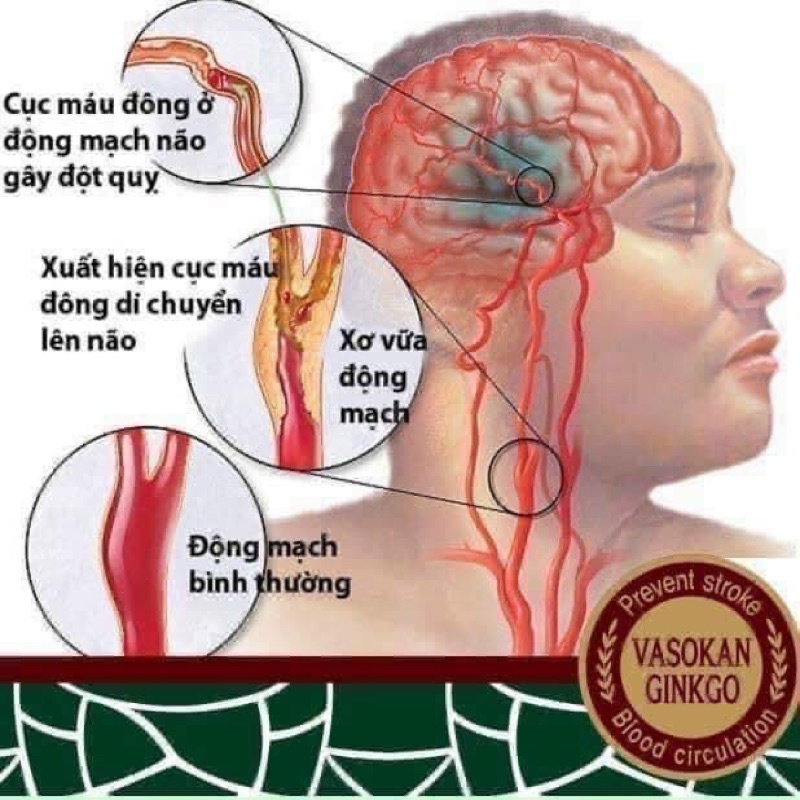 [Kèm bill , Date Dài ] An Cung Ngưu Hoàng Hoàn Hàn Quốc (Viên Hoàn Vũ Hoàng Thanh Tâm) Hộp 10 Viên