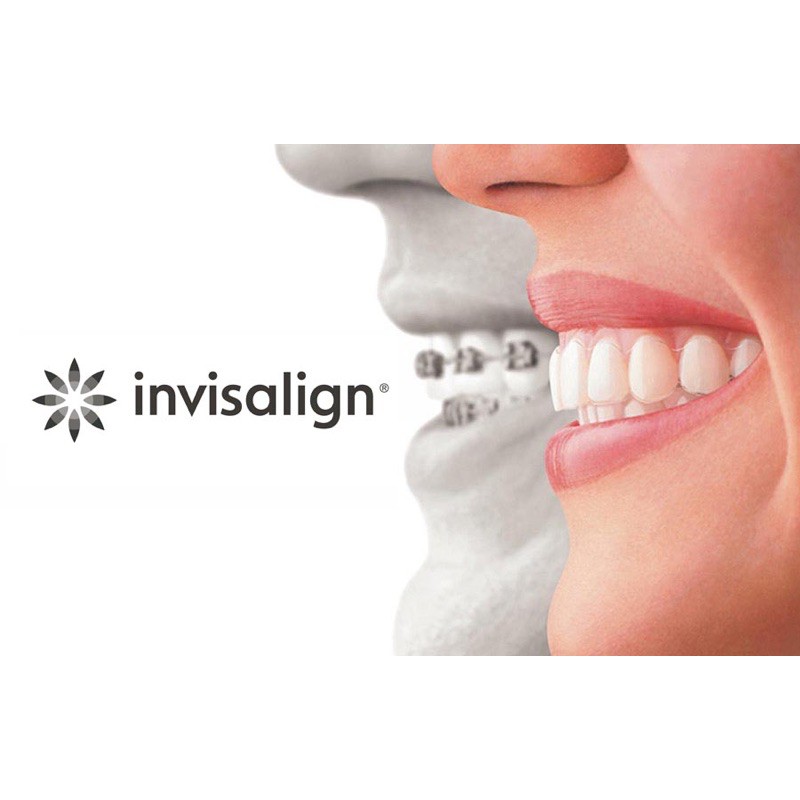 Đệm cắn chewy - Chỉnh nha INVISALIGN, chỉnh nha trong suốt