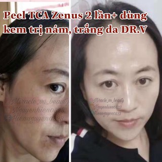 Kem Dưỡng Da Hàn Quốc DR.V